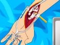 ເກມ Arm surgery 2