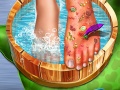 ເກມ Feet Skin Doctor