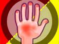 ເກມ Hands Attack