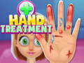ເກມ Hand Treatment