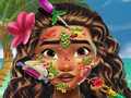 ເກມ Moana Skin Doctor