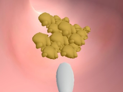 ເກມ Earwax Clinic